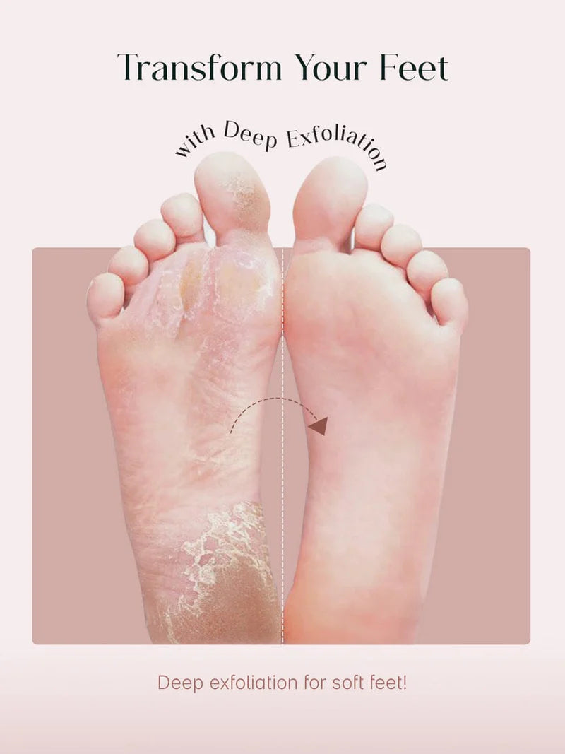 Exfoliating Foot Peel & Whitening Mask (One pair)